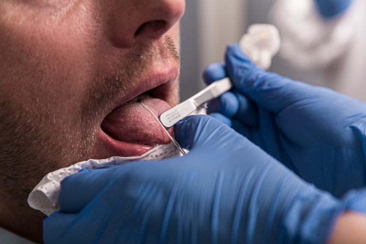 Gluing EMA sensors to the tongue